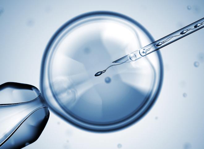 IVF Treatment Cost in Indore