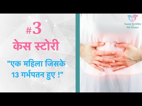 केस स्टोरी 3 - एक महिला जिसके 13 गर्भवतन हुए