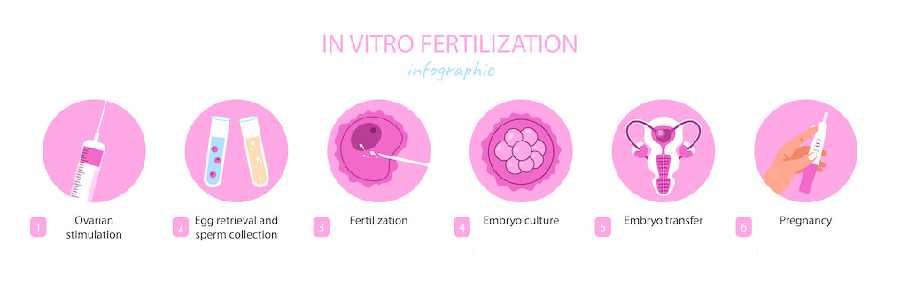 Understand the IVF Process and 5 Stages of IVF With Risk Factors 2 Understand the IVF Process and 5 Stages of IVF With Risk Factors