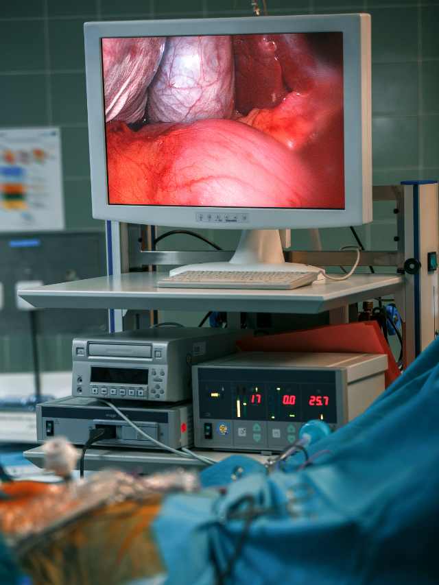 laparoscopy for infertility