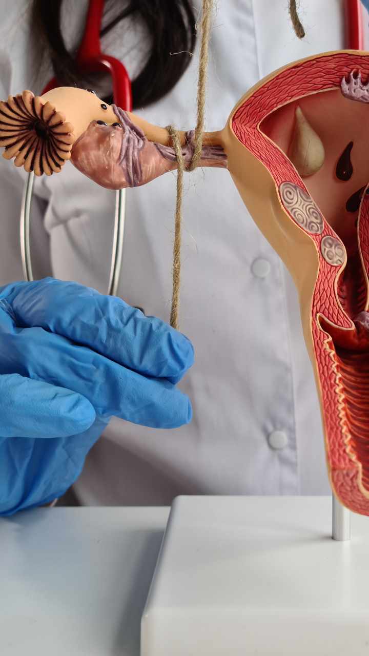 Home Page 11 An illustration showing a blocked fallopian tube with an egg unable to pass through