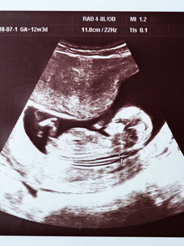 Endometrial Thickness at 5 Weeks Pregnant