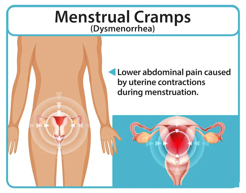 पीरियड से पहले पेट में दर्द क्यों होता है? 1 period se pehle pet mein dard kyon hota hai