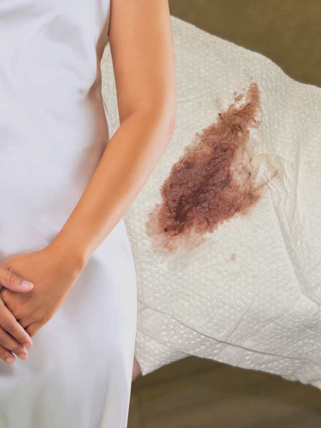 How to Stop Brown Discharge During Pregnancy Time?