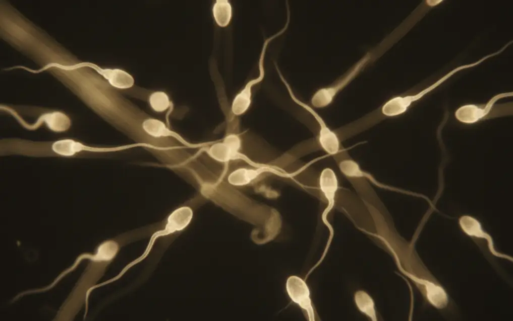 गर्भावस्था के लिए स्पर्म Motility कितनी होनी चाहिए?