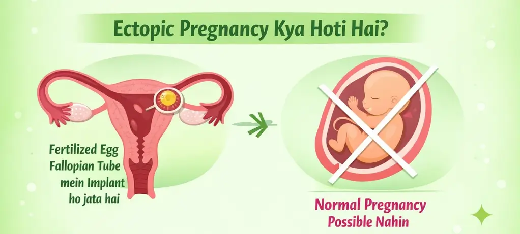 What is Ectopic Pregnancy in Hindi: कारण , लक्षण और इलाज 1 Ectopic Pregnancy Kya Hoti Hai – Ectopic Pregnancy Meaning in Hindi