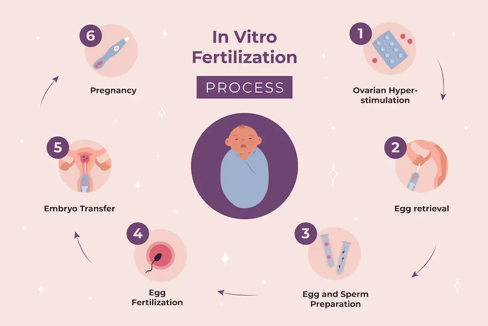 step by step ivf process