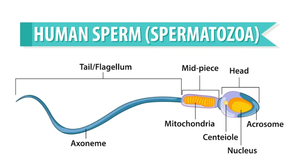 Teratozoospermia meaning?
