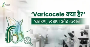 What is Varicocele in Hindi
