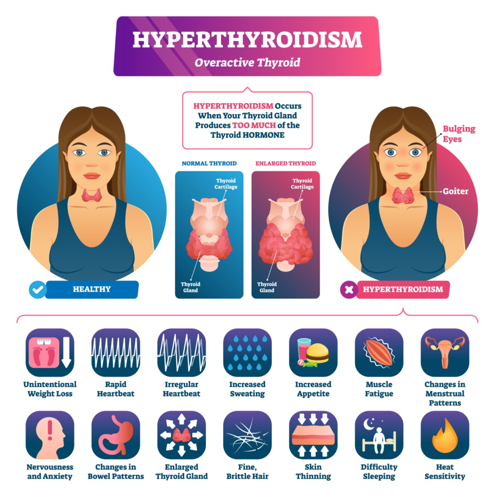 TSH Test in Hindi: Symptoms, Range & Cost